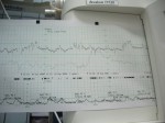 monitoring